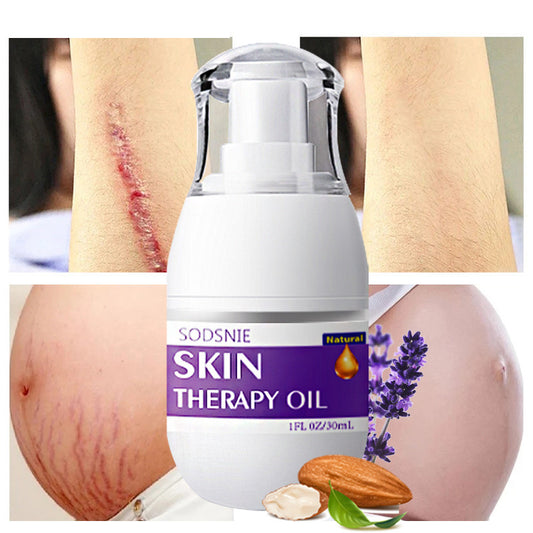 Skin Treatment Oil Remove Puncture Cellulite Stretch Mark Repair Body Care 30ml